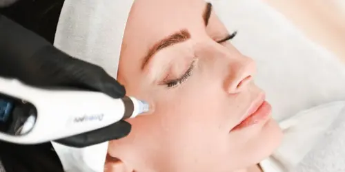 dermapen-microneedling-uppsala-banner-img-1