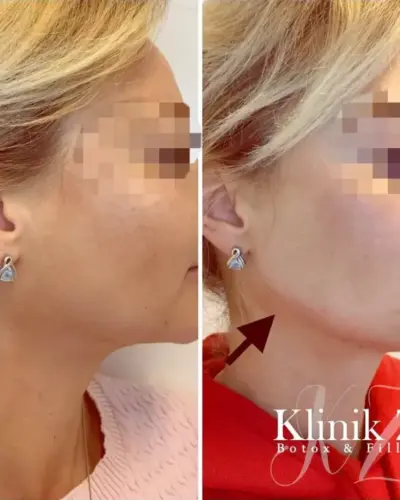 klinikzi-image-gallery-1